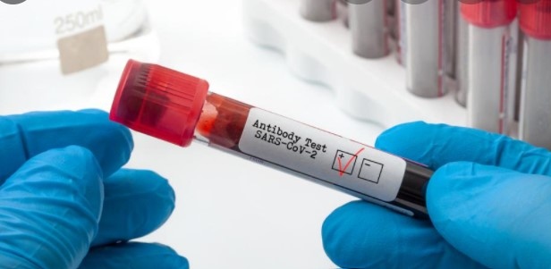 За последното денонощие у нас са регистрирани 3146 нови случая